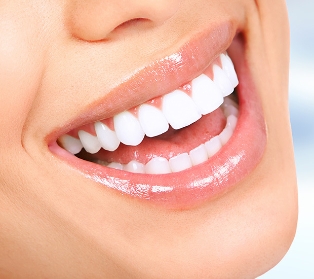 Close-up of a smiling woman showcasing bright, white teeth, emphasizing cosmetic dental enhancement relevant to smile makeovers at Smile Reflections in Tucson, AZ.