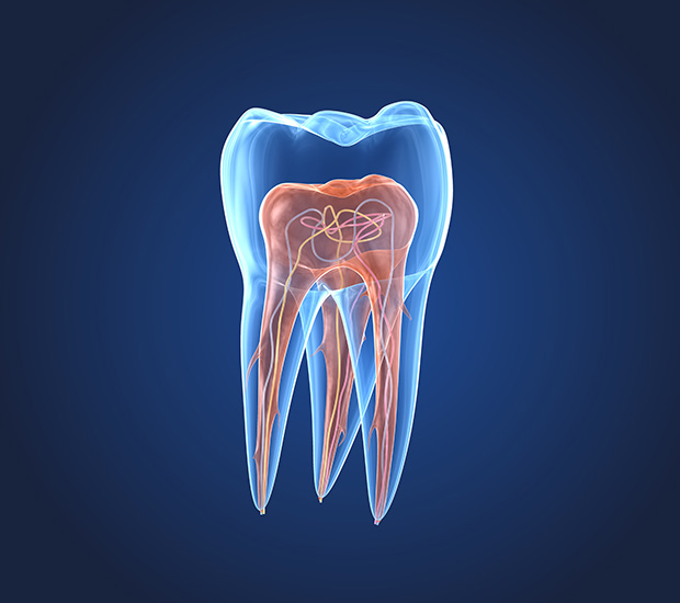 Tucson What is an Endodontist
